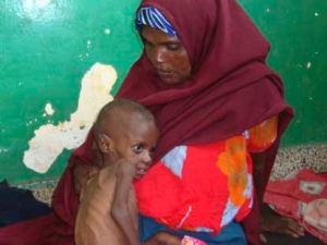 A Somali woman from southern Somalia hold her malnourished child in Banadir hospital in Mogadishu, Somalia, Thursday, July 21, 2011. Somalia's 20-year-old civil war is partly to blame for turning the drought in the Horn of Africa into a famine. Analysts warned that aid agencies could be airlifting emergency supplies to the failed state 20 years from now unless the U.N.-backed government improves.(AP Photo/Farah Abdi Warsameh)
