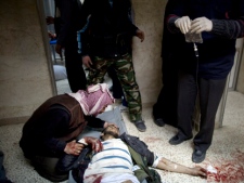 In this Sunday, March 11, 2012 photo, a man tries to help a Syrian rebel after being wounded by fragments of an exploding shell in Idlib, north Syria. (AP Photo/Rodrigo Abd). 