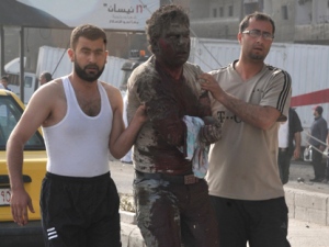 In this photo released by the Syrian official news agency SANA, Syrian citizens help an injured man after two bombs exploded at Qazaz neighborhood in Damascus, Syria, on Thursday, May 10, 2012. (AP Photo/SANA) 