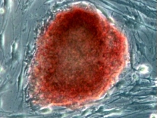 The new method uses a 'wrapping' procedure to deliver specific genes to adult cells to reprogram them into stem cells.