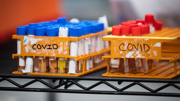 Specimens to be tested for COVID-19 are seen at LifeLabs after being logged upon receipt at the company's lab, in Surrey, B.C., Thursday, March 26, 2020. THE CANADIAN PRESS/Darryl Dyck 