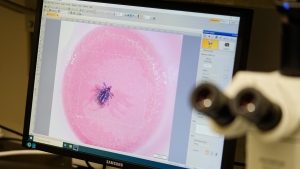 A tick is viewed atop a pencil eraser in the laboratory of researcher Erik Foster during a tour of the Center for Disease Control laboratory Thursday, April 4, 2024, in Fort Collins, Colo. (AP Photo/David Zalubowski)