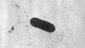 An electron microscope image made available by the Centers for Disease Control and Prevention shows a Listeria monocytogenes bacterium in a 2002 handout photo. THE CANADIAN PRESS/AP-HO, CDC, Elizabeth White, *MANDATORY CREDIT*