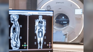 This photo provided by Prenuvo in July 2024 shows an MRI scanner. Magnetic resonance imaging uses magnetic fields to produce detailed images of organs, bones and other structures inside the body. Unlike many other types of scans, MRIs don't use radiation. (Prenuvo via AP)