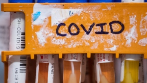 Doctors say we are in a summer wave of COVID-19. Specimens to be tested for COVID-19 are seen in Surrey, B.C., on Thursday, March 26, 2020. (The Canadian Press/Darryl Dyck)