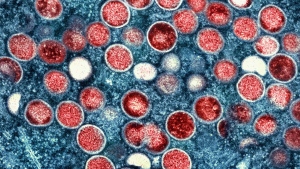 This image provided by the National Institute of Allergy and Infectious Diseases (NIAID) shows a colorized transmission electron micrograph of monkeypox particles (red) found within an infected cell (blue). (NIAID via AP, File)