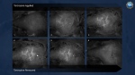 Time-lapse images of blood vessels in the brain just beneath the skull of a sedated mouse are revealed by dyeing the tissues with FD&C Yellow No. 5, a food coloring also known as tartrazine. The process doesn't involve any surgery, incisions or damaging of the mouse’s bone or skin.
Mandatory Credit:	US NSF via CNN Newsource