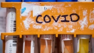 Specimens to be tested for COVID-19 are seen in Surrey, B.C., on March 26, 2020. THE CANADIAN PRESS/Darryl Dyck