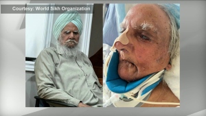 Sikh patient shaved without consent