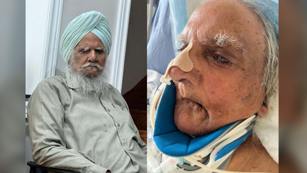 Joginder Singh Kaler, a practicing Sikh, was shaved without consent at Brampton Civic Hospital, says his family. (Kaler family photos)